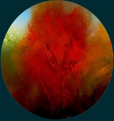 Burning Bush
