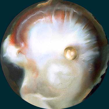 Pearl